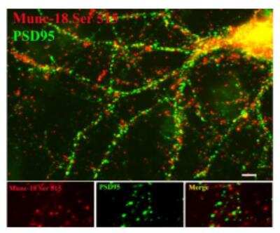 Immunohistochemistry: Syntaxin-BP1 [p Ser513] Antibody [NB300-742]